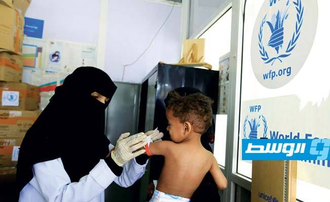 تحذير أممي من معاناة نصف أطفال اليمن من سوء التغذية خلال 2021