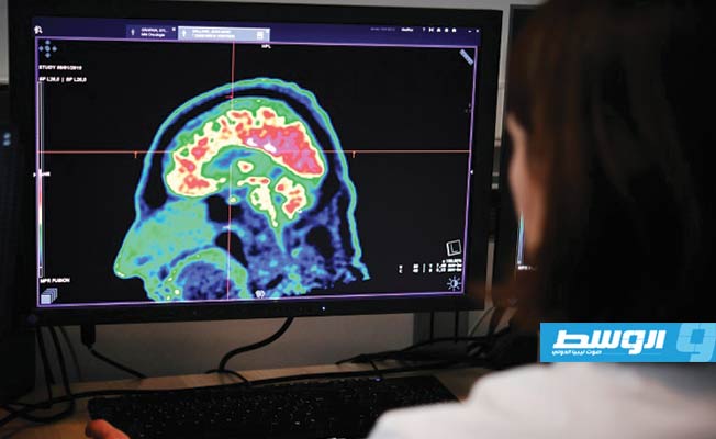 تأثير «كورونا» على الدماغ يذهل العلماء