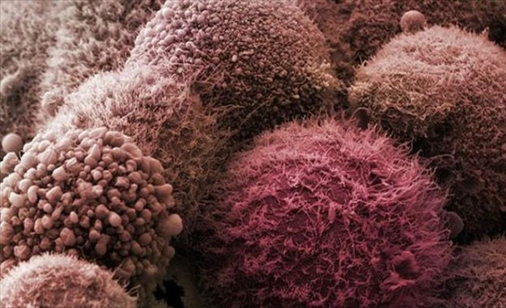 طريقة بسيطة لكشف سرطان البنكرياس