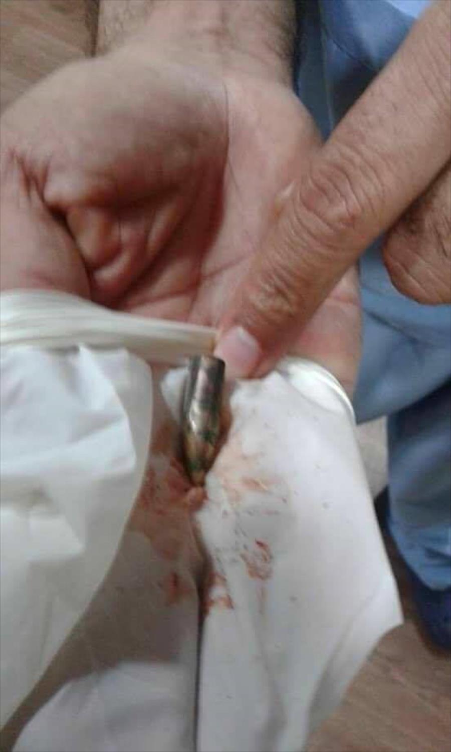 بالصور: نجاة نجم ليبيا بعد استخراج رصاصة من رأسه في القاهرة