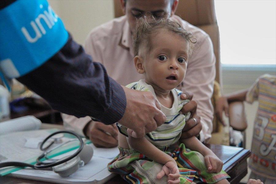 1600 وفاة بالكوليرا و300 ألف إصابة بالوباء في اليمن