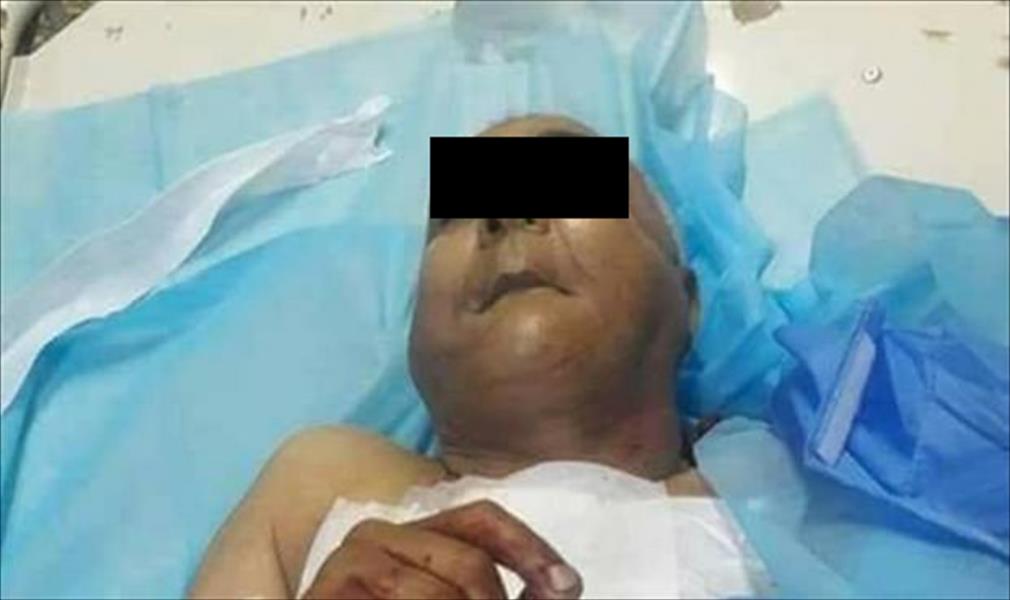 مستشفى الجلاء يتسلم جثمان مواطن تعرض للطعن في بنغازي
