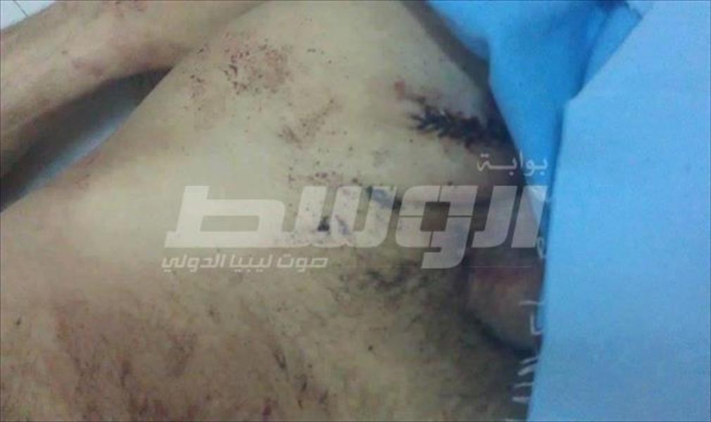 مصادر أمنية: جثث قتلى دورية الحشان عليها آثار تعذيب