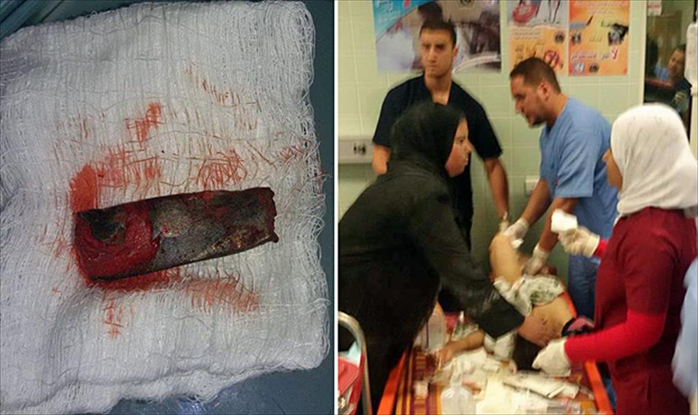 20 جريح جراء إصابتهم بشظايا في مدينة بنغازي