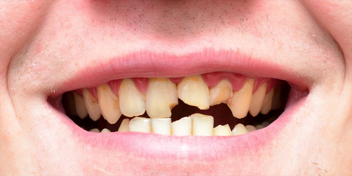 علماء يستخدمون الليزر لإعادة نمو الأسنان