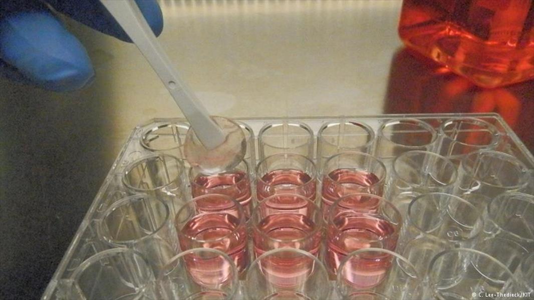 زراعة الخلايا الجذعية في الدم أحدث طريقة علاج لـ«اللوكيميا»