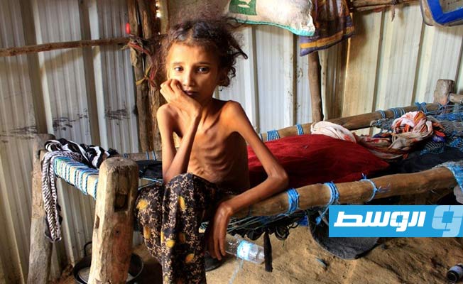 الأمم المتحدة: مؤتمر مساعدات دولي لمنع مجاعة واسعة النطاق في اليمن