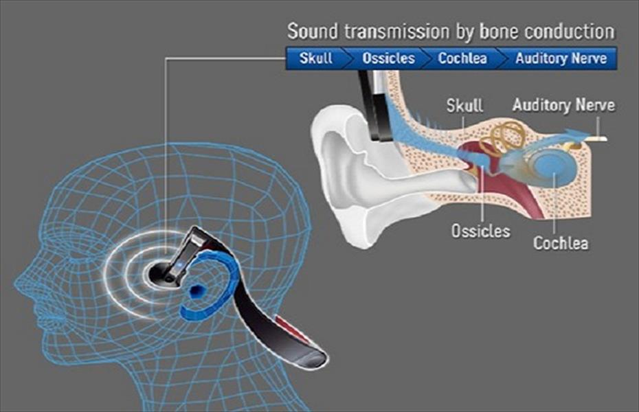 سماعة رأس من «باناسونيك» تنقل الصوت عبر عظام الجمجمة