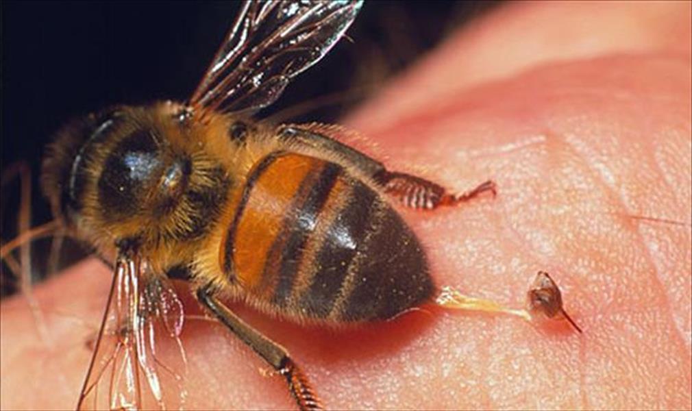 الطريقة المثلى لعلاج لدغات النحل والدبابير