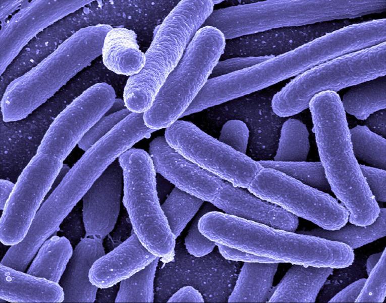 البكتيريا تعاني من إرهاق السفر مثل الإنسان