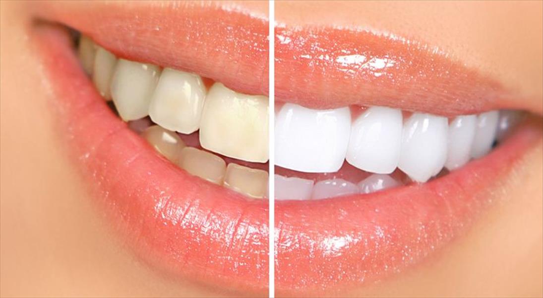 أسباب اصفرار الأسنان وعلاجها