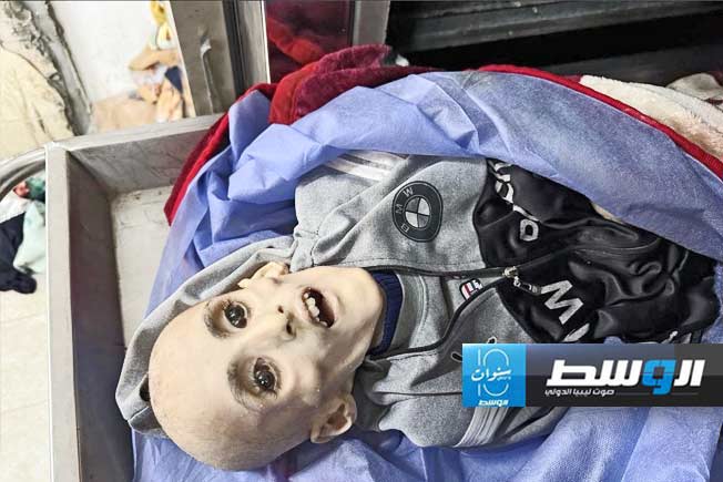 رحيل الطفل يزن «هيكلاً عظميًا» شاهدًا على «حرب التجويع» في غزة