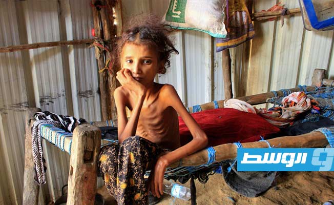 «فاو»: الجوع يتفاقم في العالم العربي
