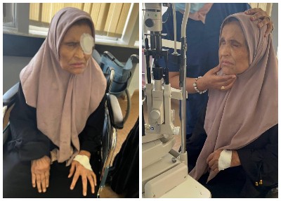 السيدة زينب الغزيوي بعد إجراء العملية الجراحية (صفحة وزارة الصحة على فيسبوك)
