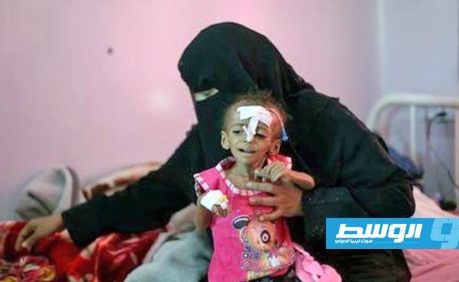 «موت مؤلم ومهين».. مسؤول أممي: اليمن سيهوي إلى مجاعة مدمرة إذا لم نمد له يد المساعدة