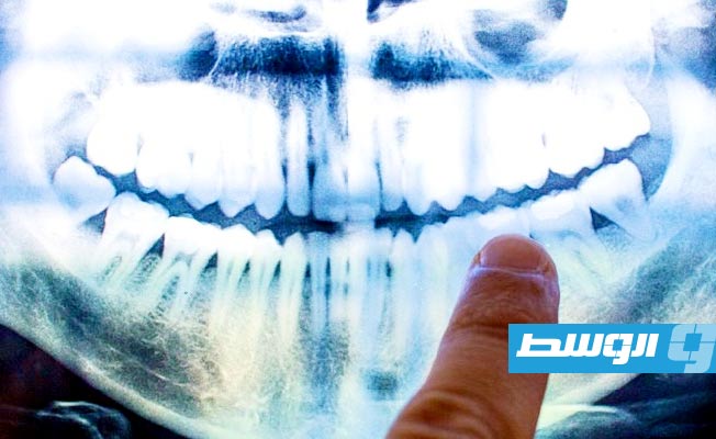 تدهور صحة الأسنان يكشف الإصابة بالزهايمر