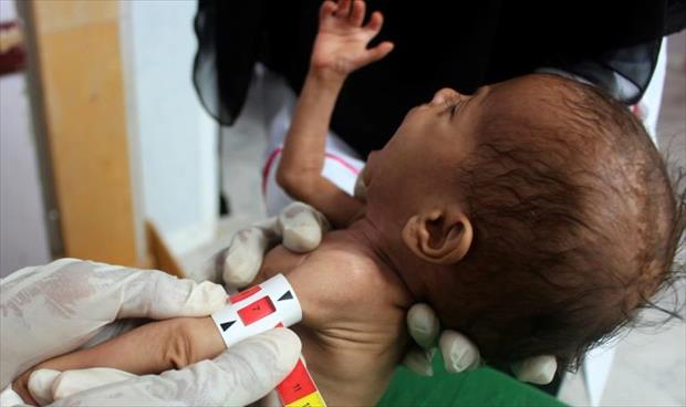 منظمات أممية: 1.2 مليون يمني يواجهون خطر الجوع خلال ستة أشهر