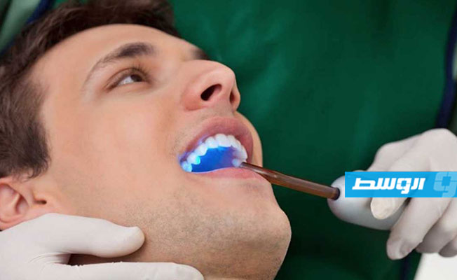 علاج تسوس الأسنان بالليزر