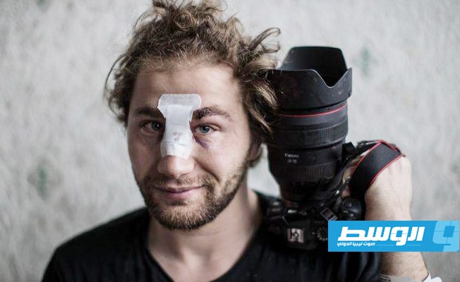 جرح مصور سوري حاز جوائز خلال تغطيته تظاهرة في باريس