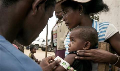 سوء التغذية «الشديد» يهدد أكثر من 500 ألف طفل في مدغشقر