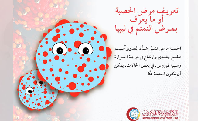 المركز الوطني الليبي لمكافحة الأمراض ينشر تقريرا مصورا حول الحصبة (فيسبوك)