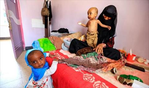 الأمم المتحدة: اليمن سيصبح أفقر دولة إذا استمرت الحرب حتى 2022