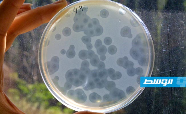 سوء استخدام المضادات الحيوية يفتح الباب أمام «البكتيريا الخارقة»