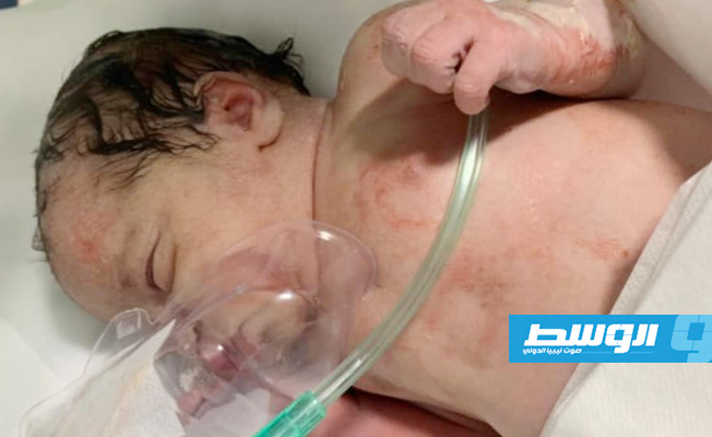 ولادة طفل لمصابة بـ«كورونا» في مركز عزل بمصراتة