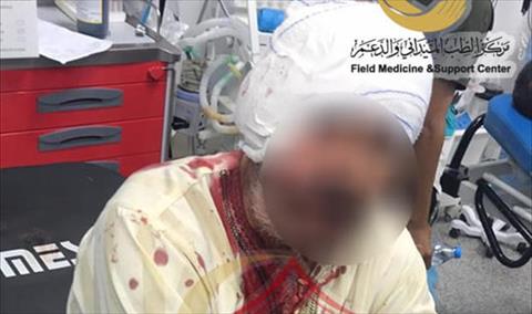 الهاشمي: إصابة مسن نتيجة سقوط قذيفة عشوائية على منطقة طريق السور