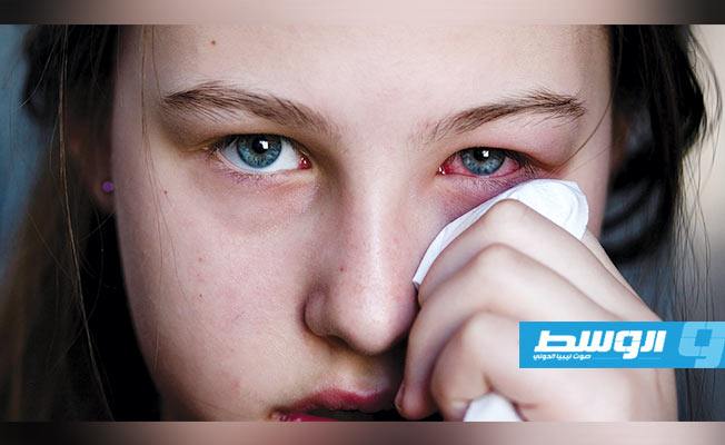 كيف تحمي عينيك من «متلازمة سيكا»؟
