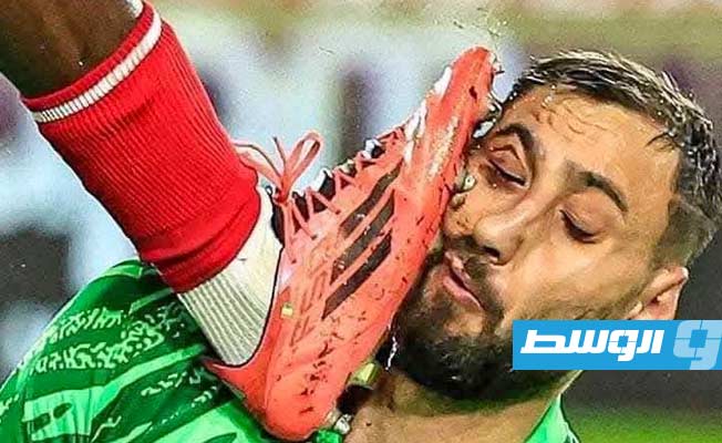 إصابة دوناروما خلال مباراة باريس سان جيرمان وموناكو بالدوري الفرنسي الأربعاء 18 ديسمبر 2024 (فيسبوك)