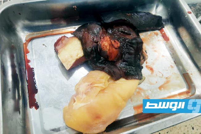 لحوم فاسدة عثر عليها في محل جزارة بالجفارة، 8 سبتمبر 2025. (الرقابة على الأغذية)